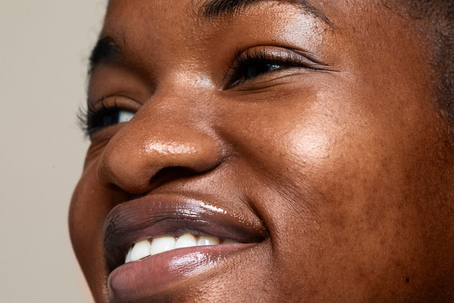 Taches et Hyperpigmentation : Le Défi Majeur des Peaux Métissées - MUSSOFI